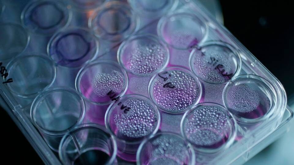 Ισραηλινοί επιστήμονες έχουν εντοπίσει την «Αχίλλειο πτέρνα» των καρκινικών κυττάρων