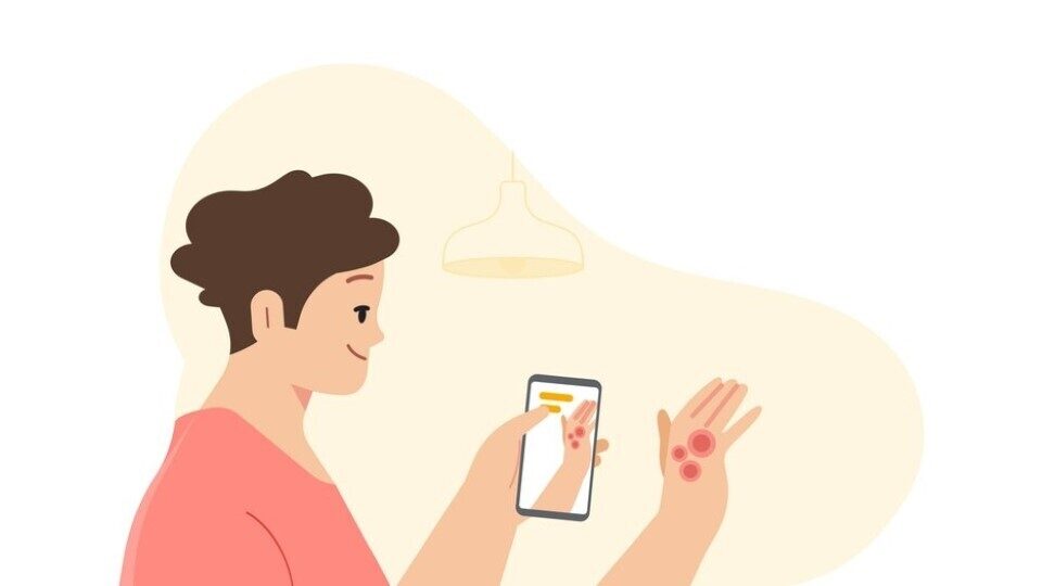 Google: Ετοιμάζει εργαλείο AI για την διάγνωση παθήσεων του δέρματος
