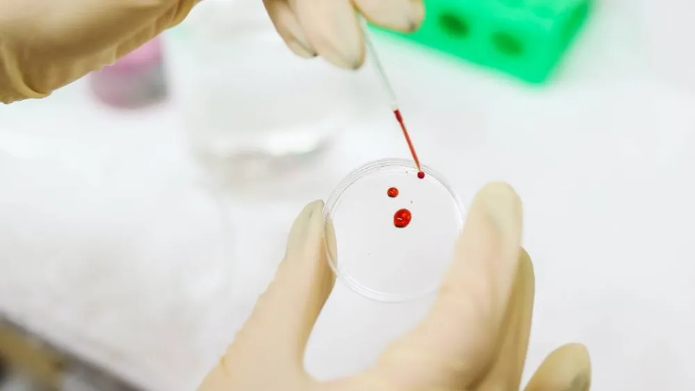 «Επαναστατική» εξέταση αίματος μπορεί να ανιχνεύσει 50 τύπους καρκίνου