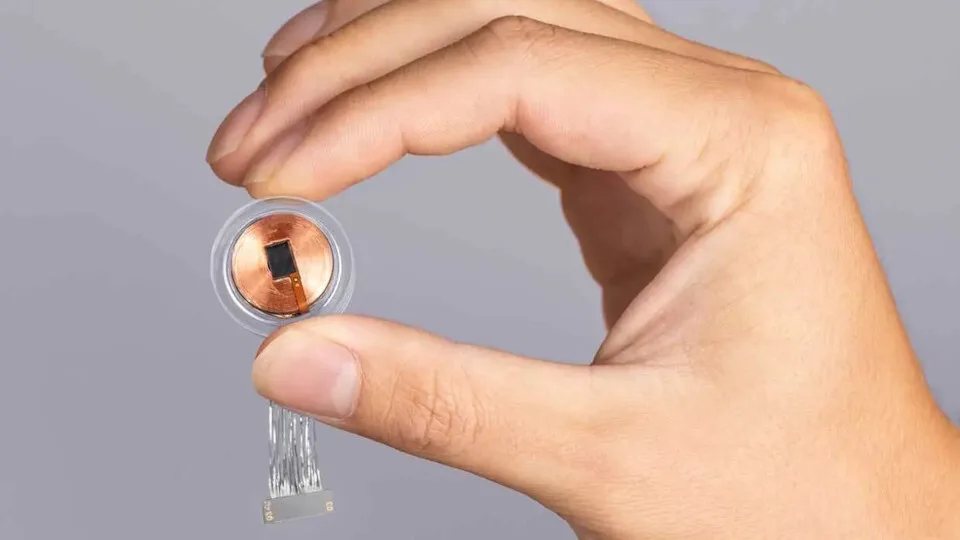 Neuralink: Εμφύτευσε τη συσκευή της και σε δεύτερο ασθενή