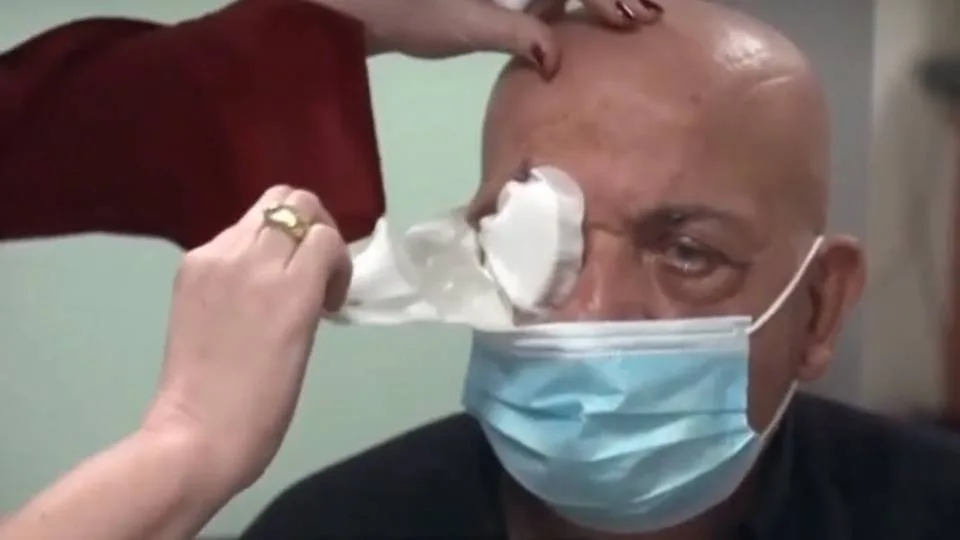 Τυφλός ανέκτησε την όραση του με τεχνητό κερατοειδή που έφτιαξε startup