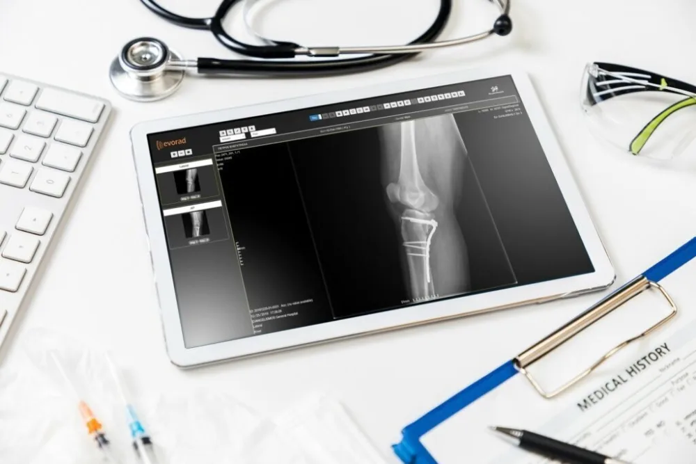 Σε λειτουργία ο Ψηφιακός Βοηθός Ιατρού στον Εθνικό Ηλεκτρονικό Φάκελο Υγείας – Η Τεχνητή Νοημοσύνη αξιοποιείται στον τομέα της Υγείας